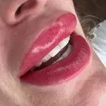 Lippigmentatie